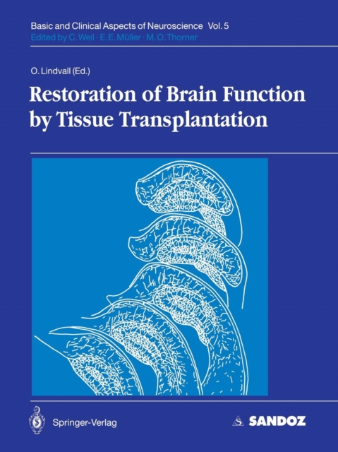 Restoration of Brain Function by Tissue Transplantation, Paperback / softback Book