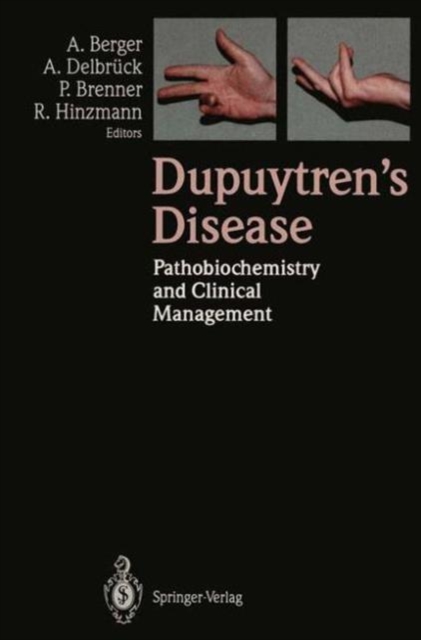 Dupuytren's Disease : Pathobiochemistry and Clinical Management, Paperback / softback Book