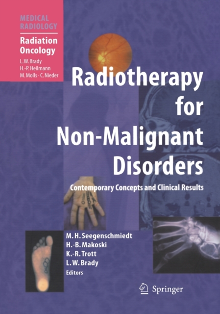 Radiotherapy for Non-Malignant Disorders, Hardback Book