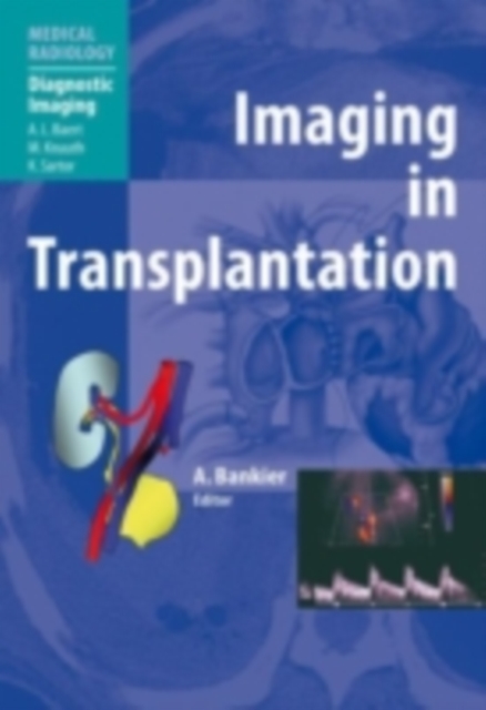 Imaging in Transplantation, PDF eBook