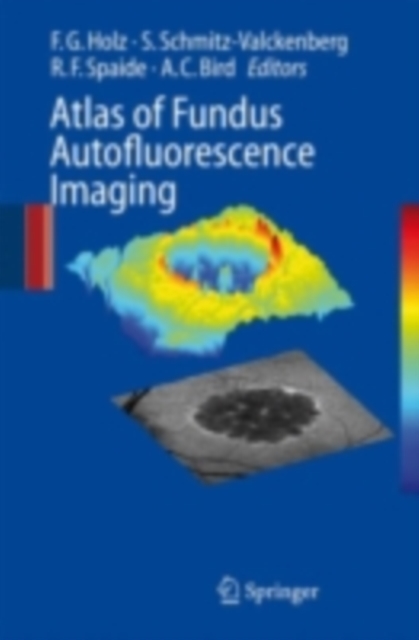Atlas of Fundus Autofluorescence Imaging, PDF eBook
