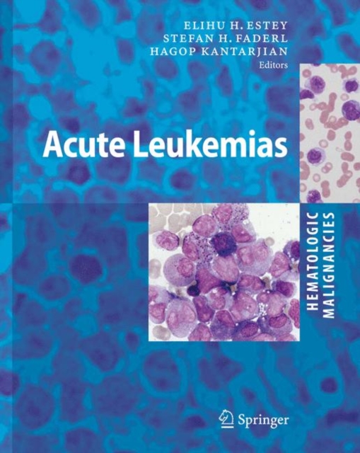 Hematologic Malignancies: Acute Leukemias, Hardback Book