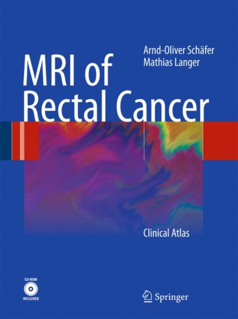 MRI of Rectal Cancer : Clinical Atlas, Mixed media product Book