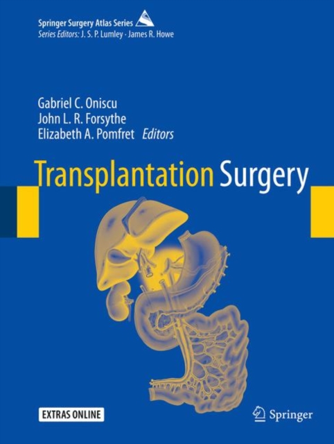 Transplantation Surgery, Hardback Book