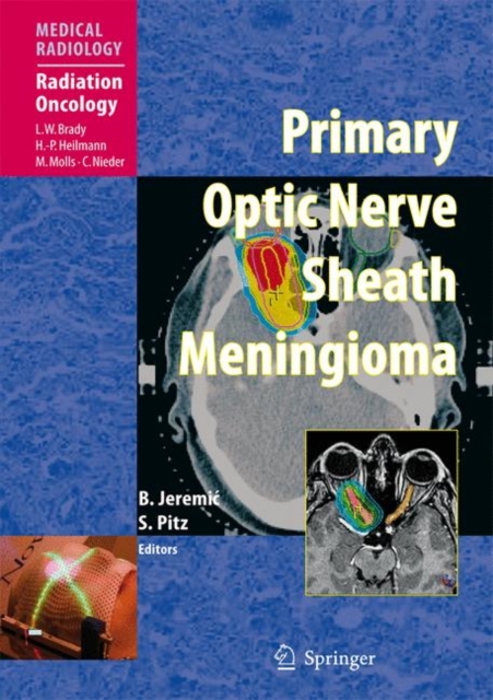 Primary Optic Nerve Sheath Meningioma, Hardback Book