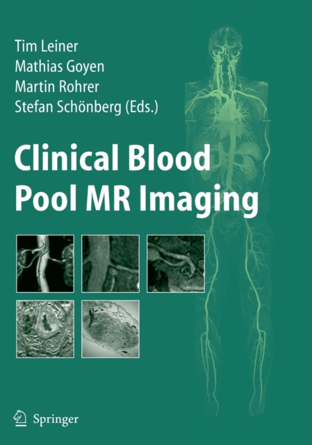 Clinical Blood Pool MR Imaging, Hardback Book