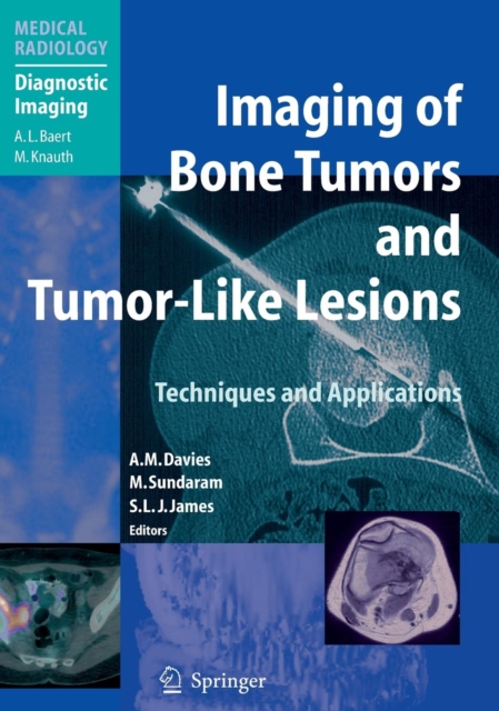 Imaging of Bone Tumors and Tumor-like Lesions : Techniques and Applications, Hardback Book