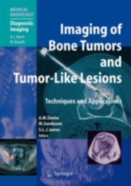 Imaging of Bone Tumors and Tumor-Like Lesions : Techniques and Applications, PDF eBook