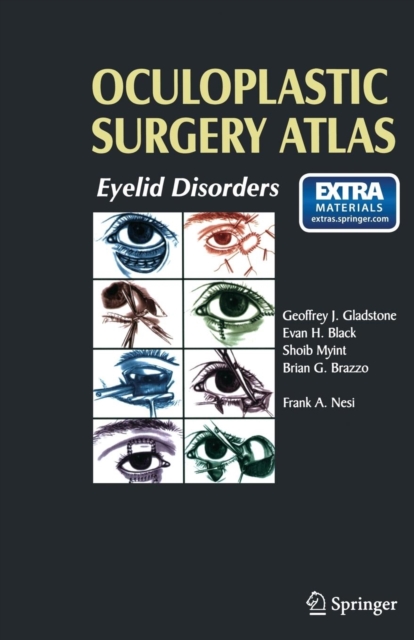 Oculoplastic Surgery Atlas : Eyelid Disorders, Paperback / softback Book
