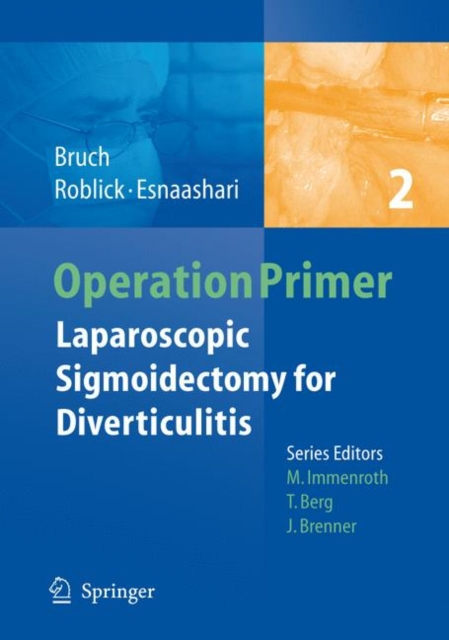 Laparoscopic Sigmoidectomy for Diverticulitis, Paperback / softback Book