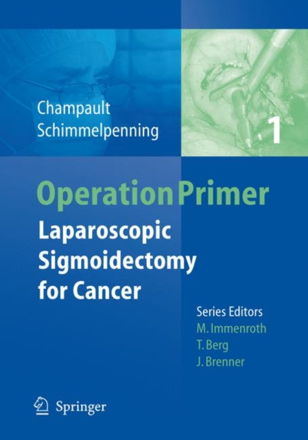 Laparoscopic Sigmoidectomy for Cancer, Paperback / softback Book