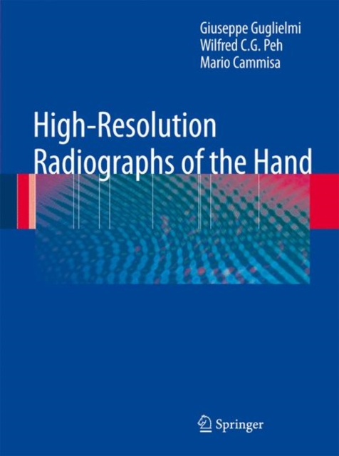 High-resolution Radiographs of the Hand, Hardback Book