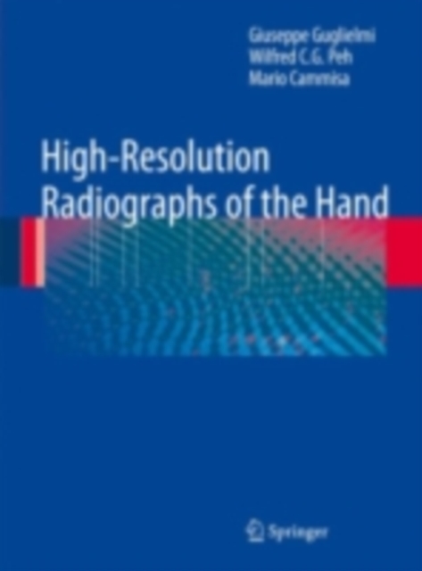 High-Resolution Radiographs of the Hand, PDF eBook