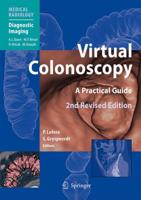 Virtual Colonoscopy : A Practical Guide, Hardback Book