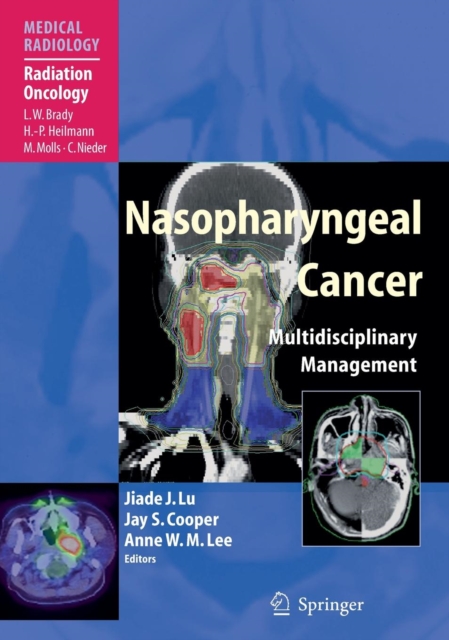 Nasopharyngeal Cancer : Multidisciplinary Management, Hardback Book