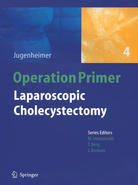 Laparoscopic Cholecystectomy, Paperback / softback Book
