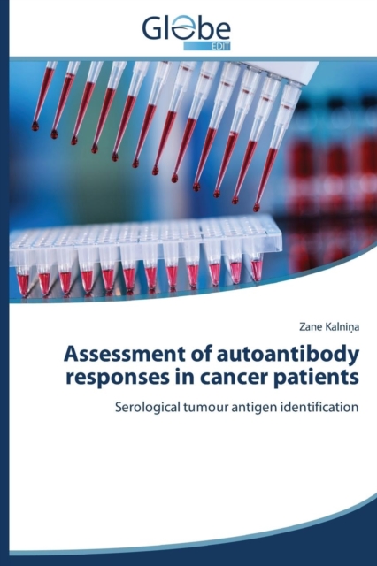 Assessment of autoantibody responses in cancer patients, Paperback / softback Book