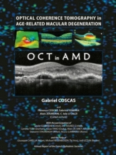 Optical Coherence Tomography in Age-Related Macular Degeneration, PDF eBook