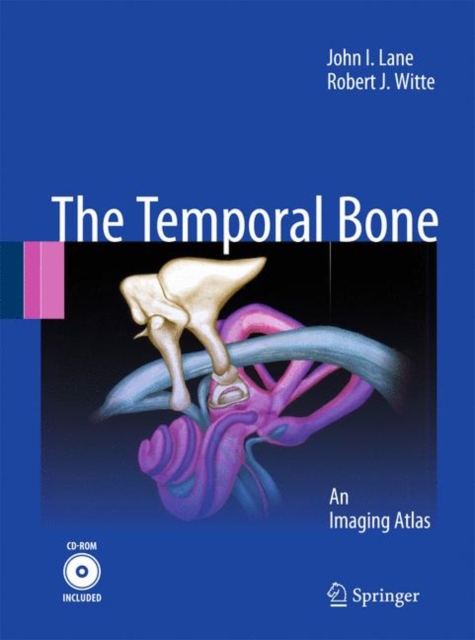 Temporal Bone : An Imaging Atlas, Mixed media product Book