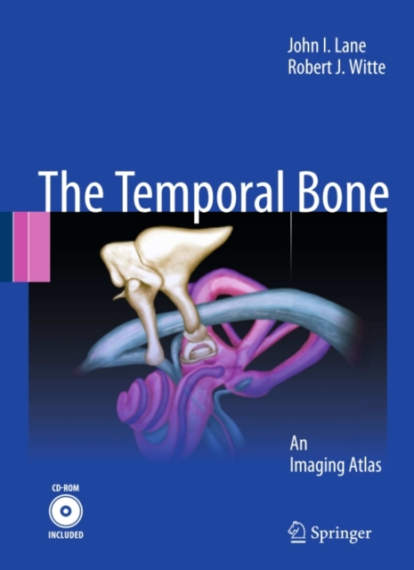Temporal Bone : An Imaging Atlas, PDF eBook
