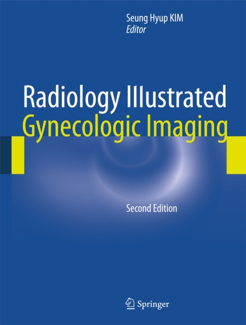 Radiology Illustrated: Gynecologic Imaging, Hardback Book