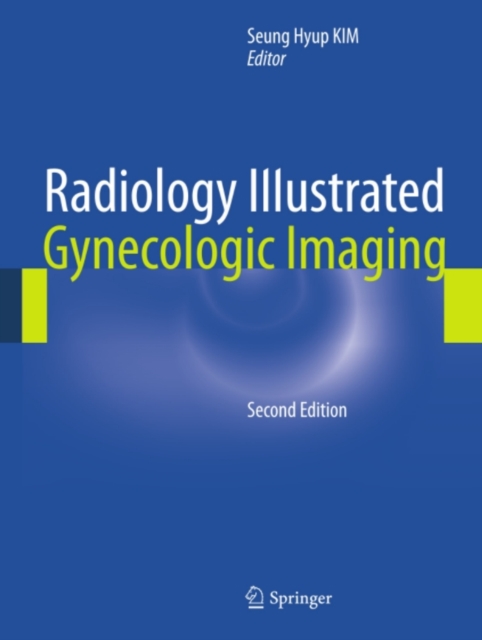 Radiology Illustrated: Gynecologic Imaging, PDF eBook