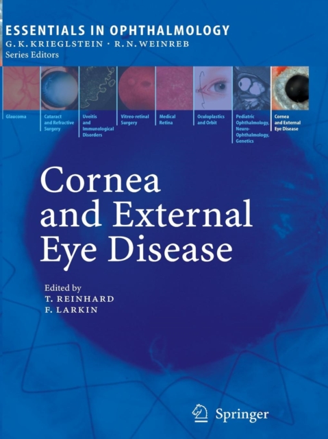 Cornea and External Eye Disease, Paperback / softback Book