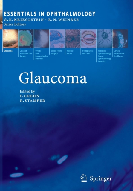 Glaucoma, Paperback / softback Book