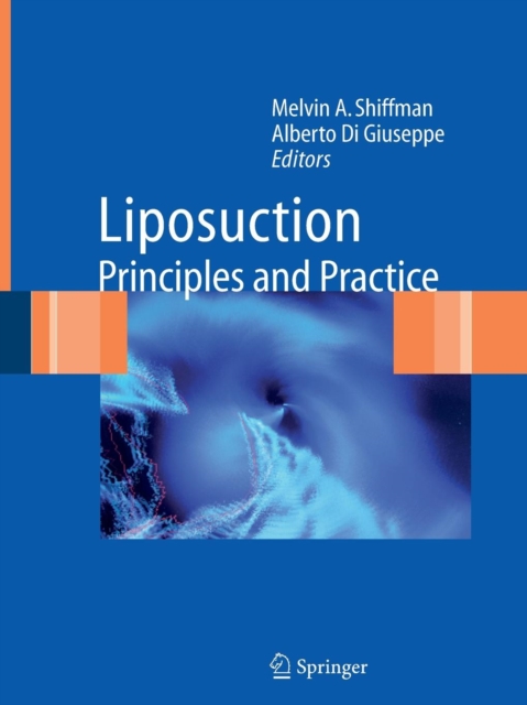 Liposuction : Principles and Practice, Paperback / softback Book