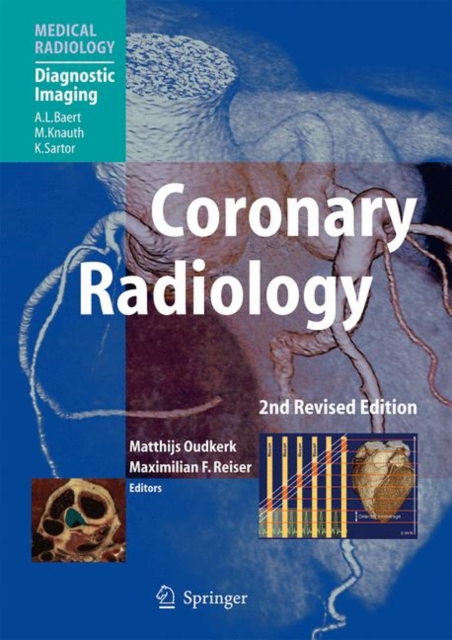 Coronary Radiology, Paperback / softback Book