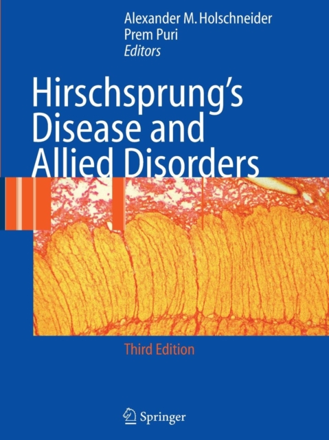 Hirschsprung's Disease and Allied Disorders, Paperback / softback Book