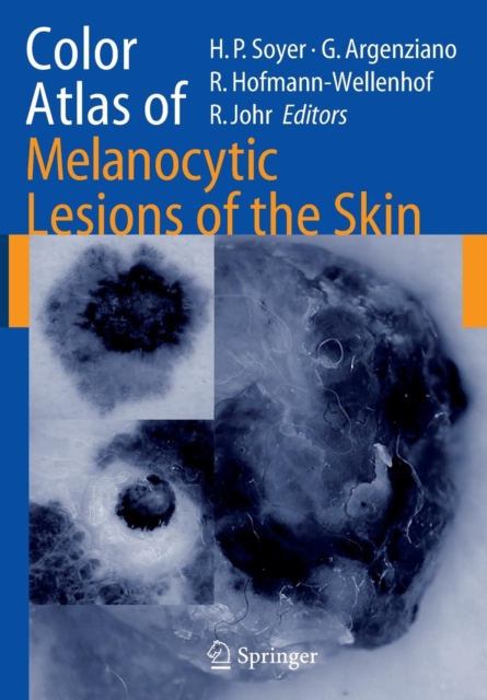 Color Atlas of Melanocytic Lesions of the Skin, Paperback / softback Book