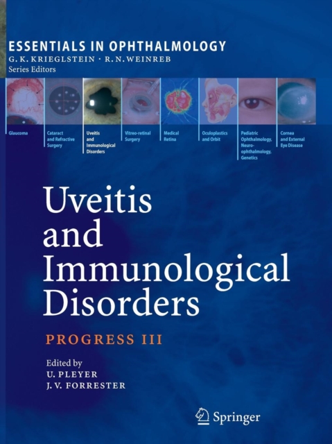 Uveitis and Immunological Disorders : Progress III, Paperback / softback Book