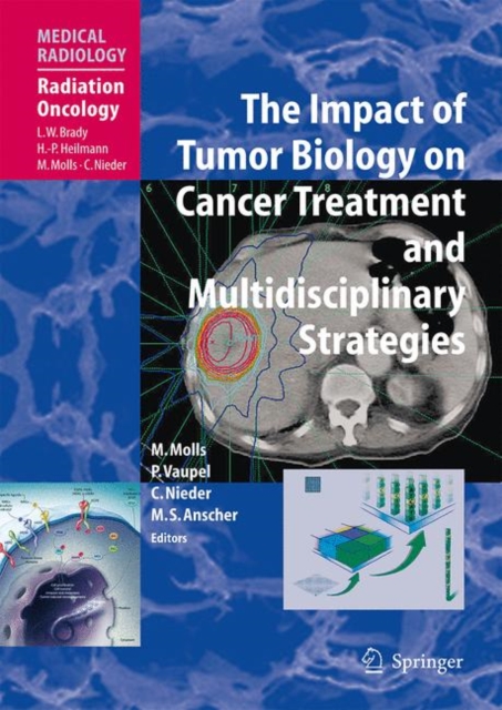 The Impact of Tumor Biology on Cancer Treatment and Multidisciplinary Strategies, Paperback / softback Book