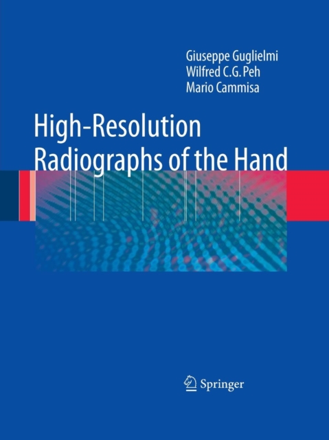 High-Resolution Radiographs of the Hand, Paperback / softback Book