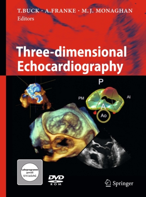 Three-dimensional Echocardiography, PDF eBook