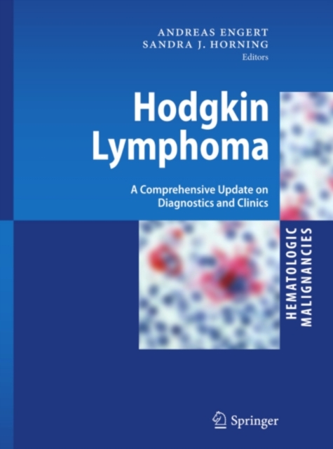 Hodgkin Lymphoma : A Comprehensive Update on Diagnostics and Clinics, PDF eBook