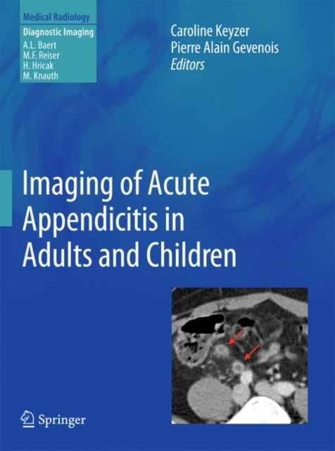 Imaging of Acute Appendicitis in Adults and Children, Hardback Book