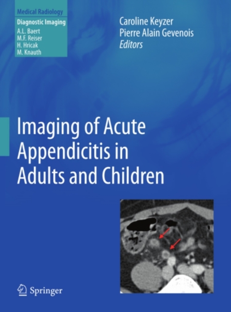 Imaging of Acute Appendicitis in Adults and Children, PDF eBook