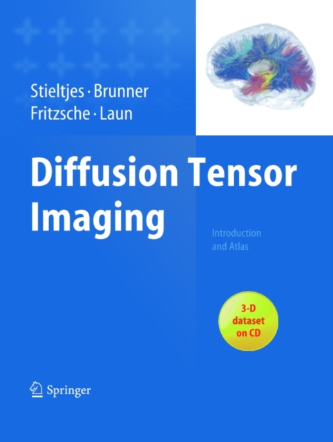Diffusion Tensor Imaging : Introduction and Atlas, PDF eBook