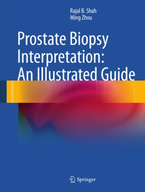 Prostate Biopsy Interpretation: An Illustrated Guide, PDF eBook