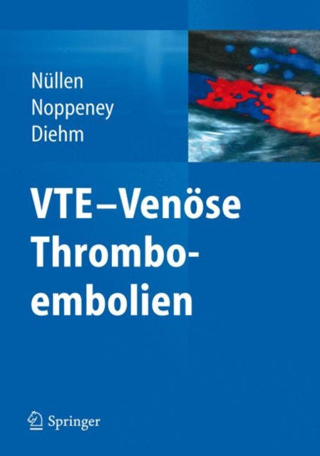 VTE - Venose Thromboembolien, Hardback Book