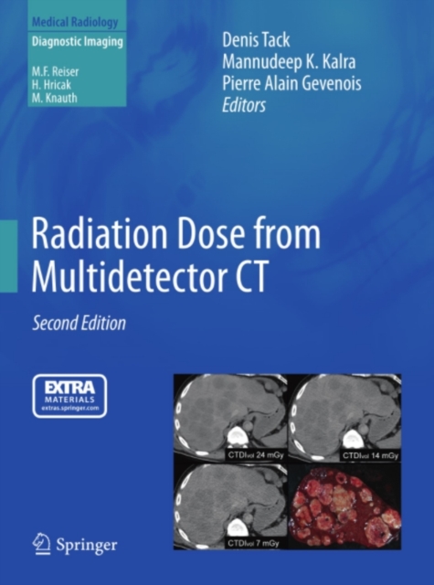 Radiation Dose from Multidetector CT, PDF eBook