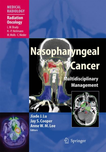 Nasopharyngeal Cancer : Multidisciplinary Management, Paperback / softback Book