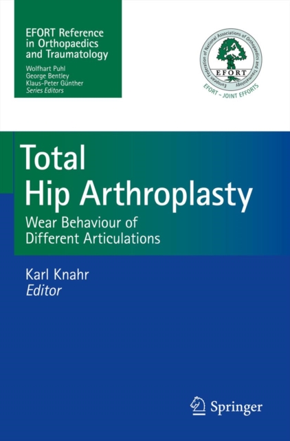Total Hip Arthroplasty : Wear Behaviour of Different Articulations, PDF eBook