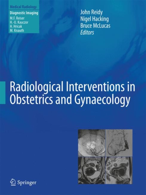 Radiological Interventions in Obstetrics and Gynaecology, Hardback Book