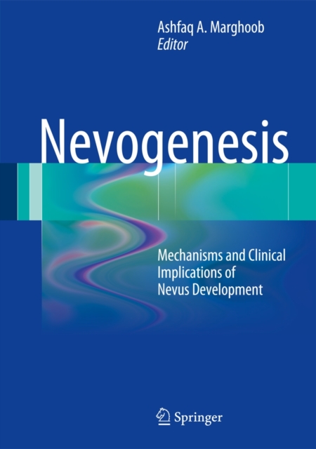 Nevogenesis : Mechanisms and Clinical Implications of Nevus Development, Hardback Book