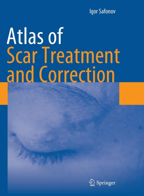 Atlas of Scar Treatment and Correction, Hardback Book