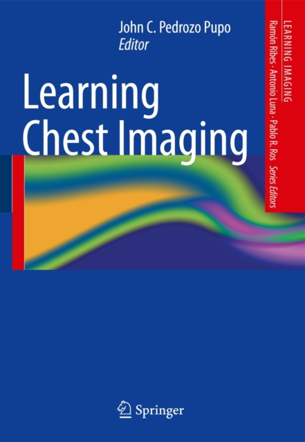 Learning Chest Imaging, Paperback / softback Book