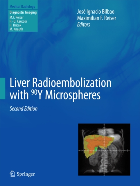 Liver Radioembolization with 90Y Microspheres, Hardback Book